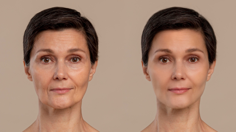 Reason for Skin Aging by Believe Aesthetics in San Antonio , TX